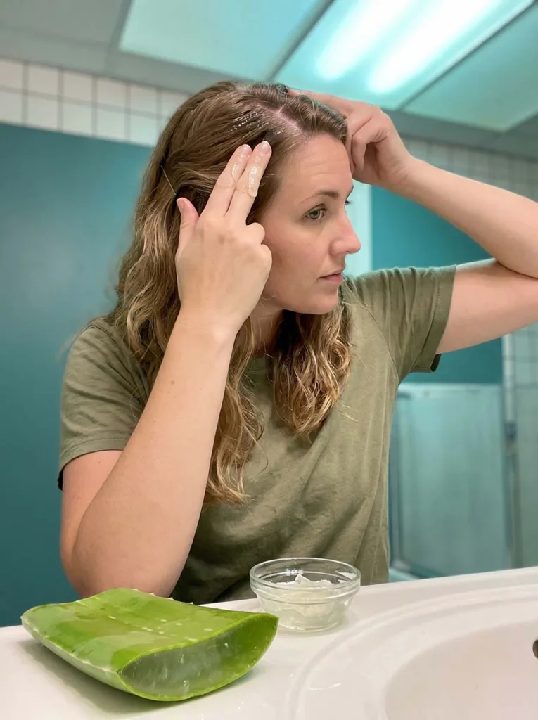 Fresh aloe vera leaf sliced open with clear gel being scooped out and applied to a woman's scalp to calm dandruff inflammation