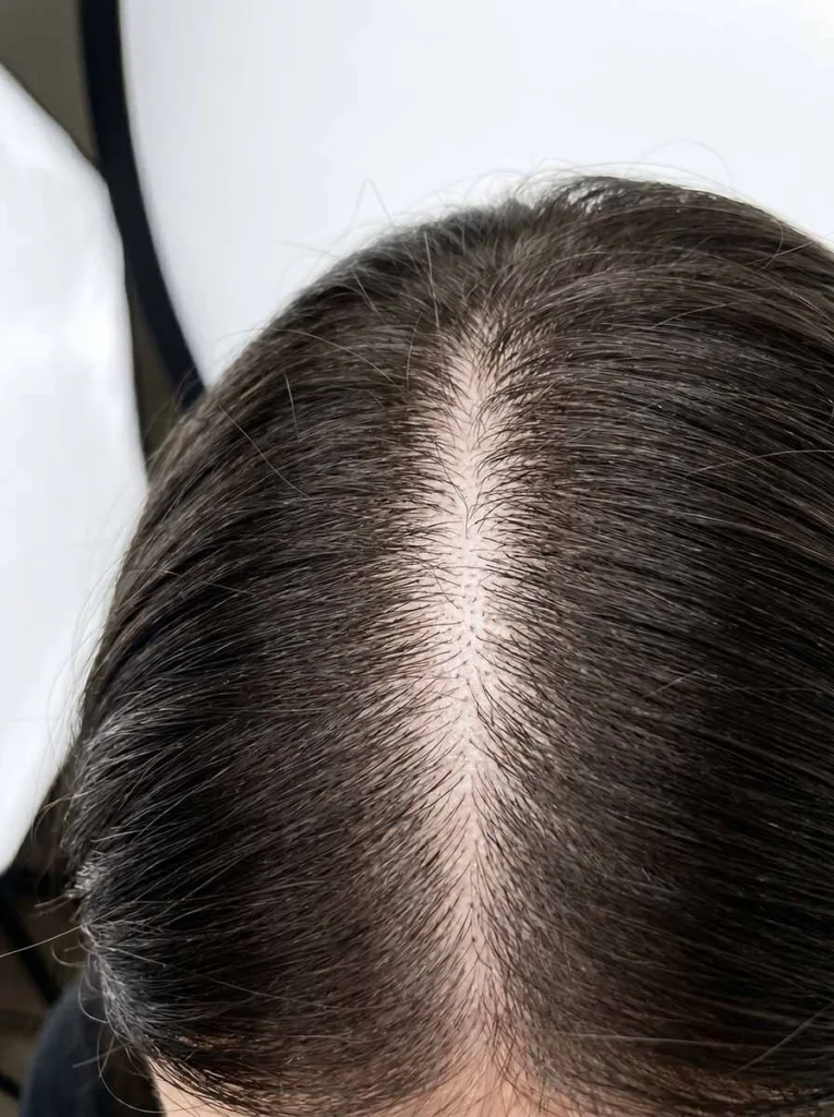 close-up of a healthy scalp with clean roots showing the foundation of a strong hair care routine