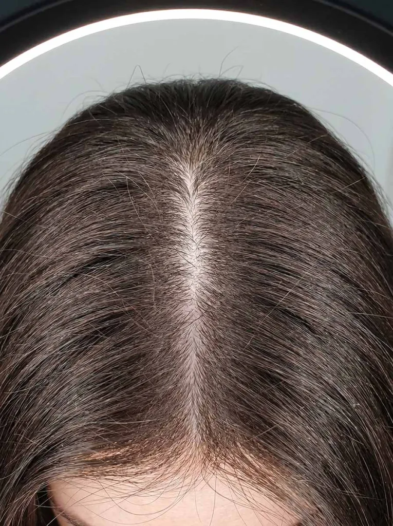 close-up of woman's scalp parting showing thinning hair and visible scalp