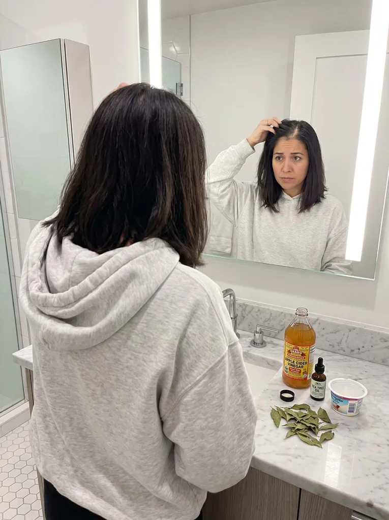 Woman examining her scalp in a bathroom mirror with a concerned expression, surrounded by several used natural remedy bottles on the counter