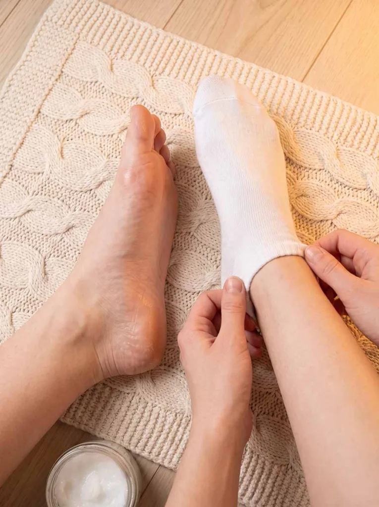 coconut oil applied to dry heels and feet with cotton socks for overnight winter skin treatment