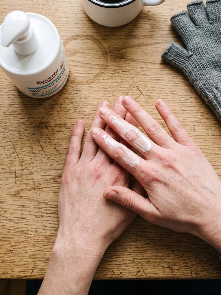 fair-skinned dry winter hands applying Eucerin Advanced Repair Cream to knuckles