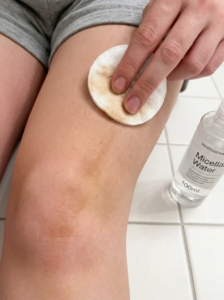 Close-up of a hand pressing a cotton pad soaked in micellar water onto a self-tanner streak on a fair-skinned knee