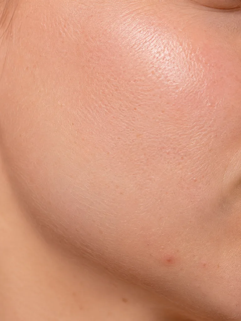 Extreme close-up of natural skin texture representing different skin types